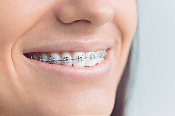 Best Invisalign and Clear Aligners  in Elizabethtown, PA